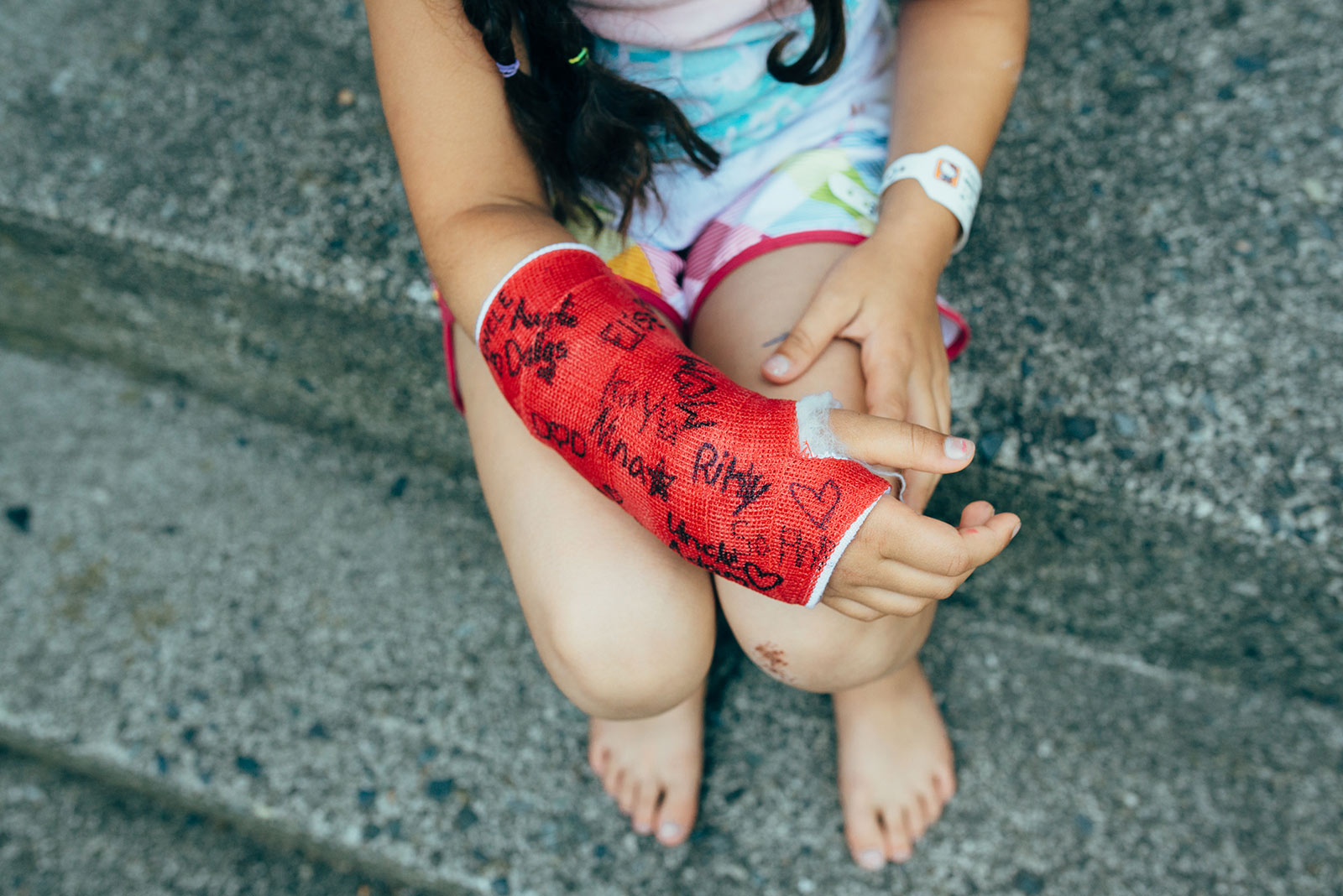 Lapsi istuu portailla käsi kipsissä.